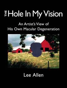 The Hole in My Vision, Cover