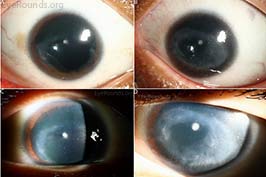 Inherited Eye Disease: Online Atlas Of Ophthalmology