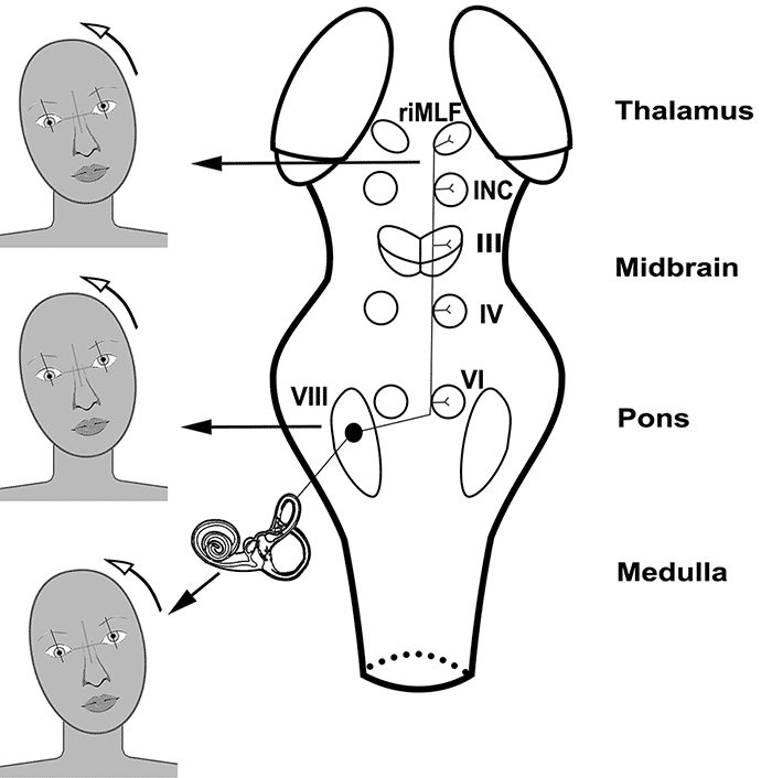 A schematic showing the pathway of vestibular input to the vestibulo-ocular reflex (VOR) (see Neuroanatomy and Localization section in the article for more detailed information). 