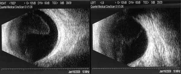 Ultrasound. Click on image for larger view