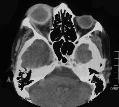 Axial Ct Scan