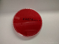 Blood agar