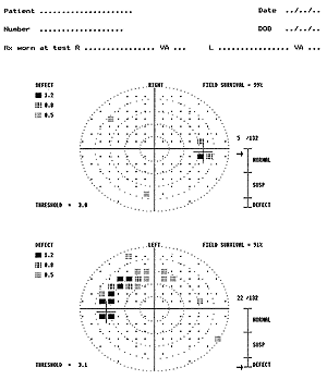 Visual Field Test Chart