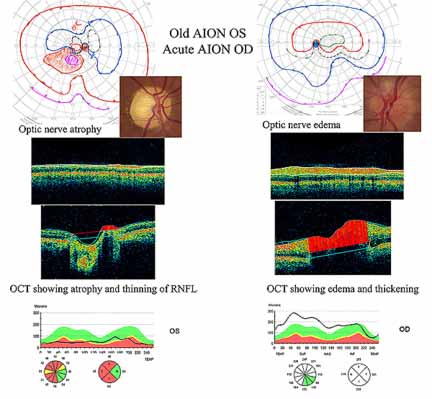 see legend below for description