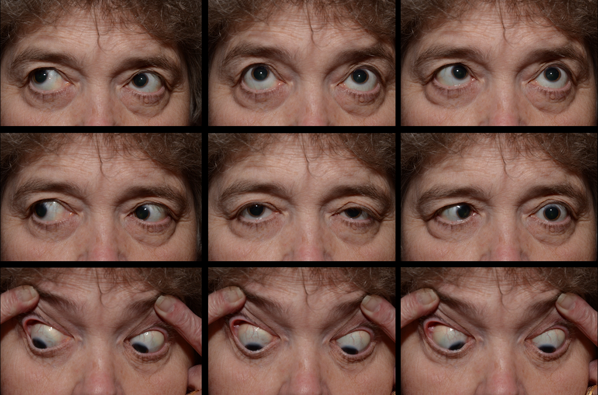 testing eye movement with multiple gazes