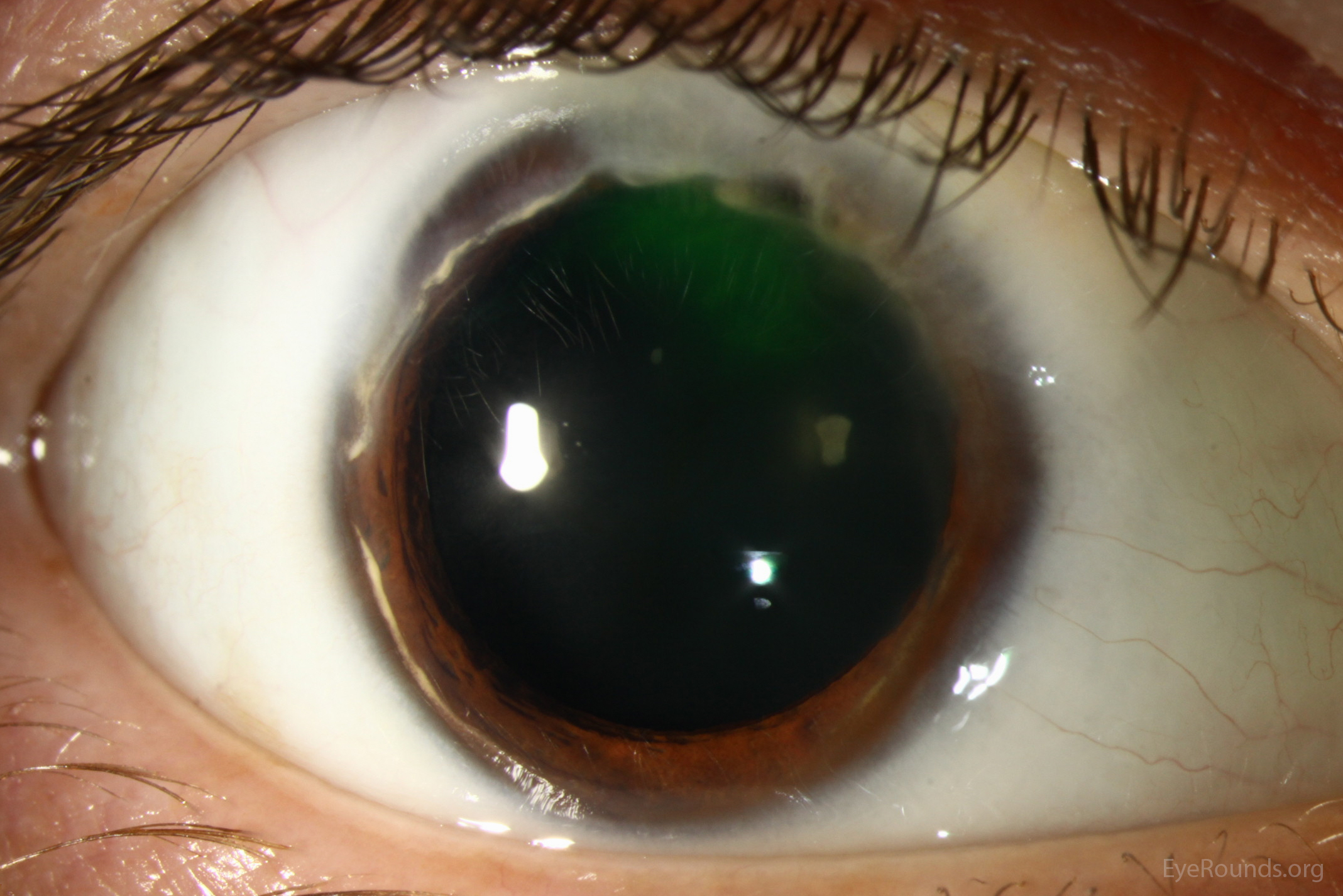  External view of eye 