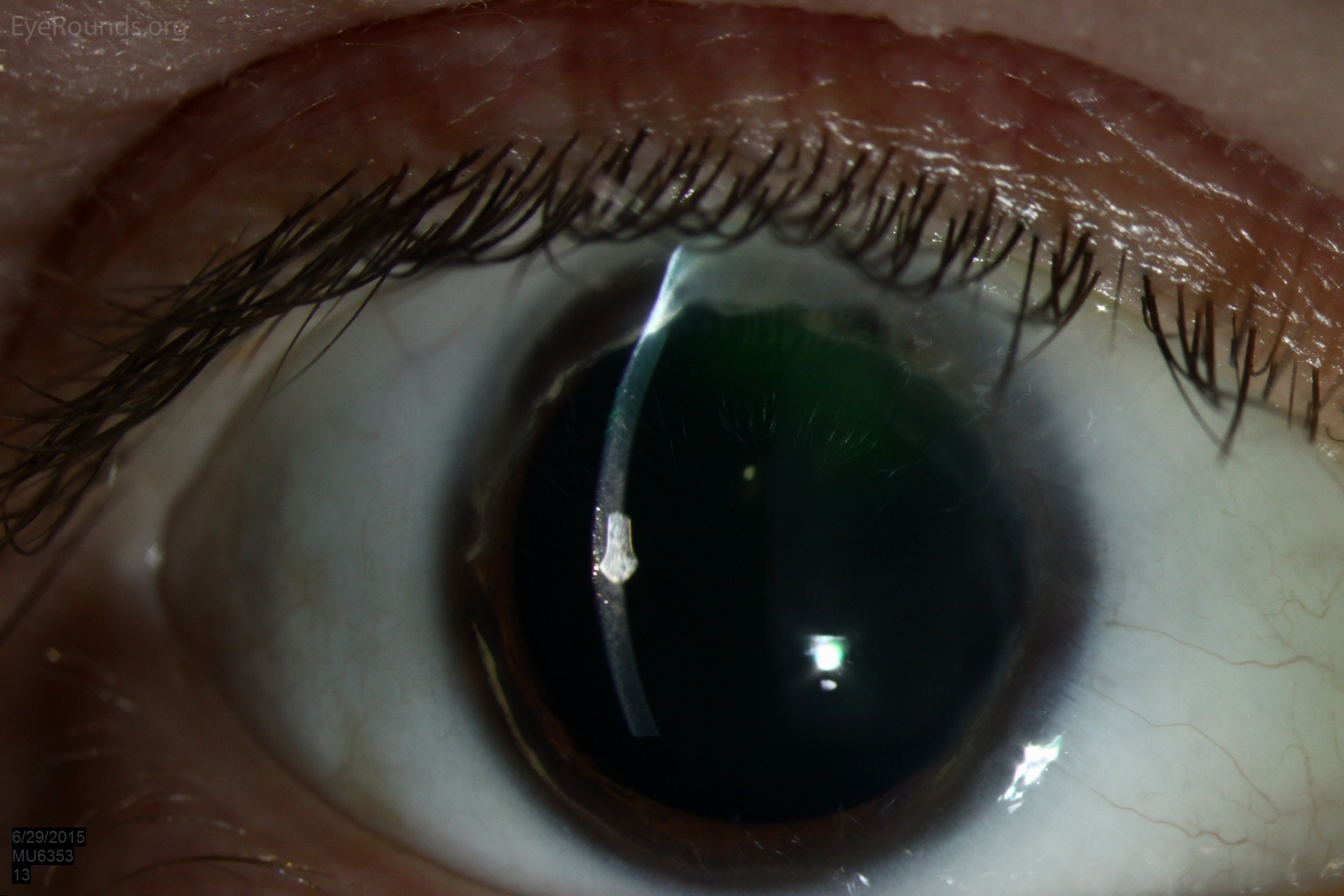  External view of slit lamp eye