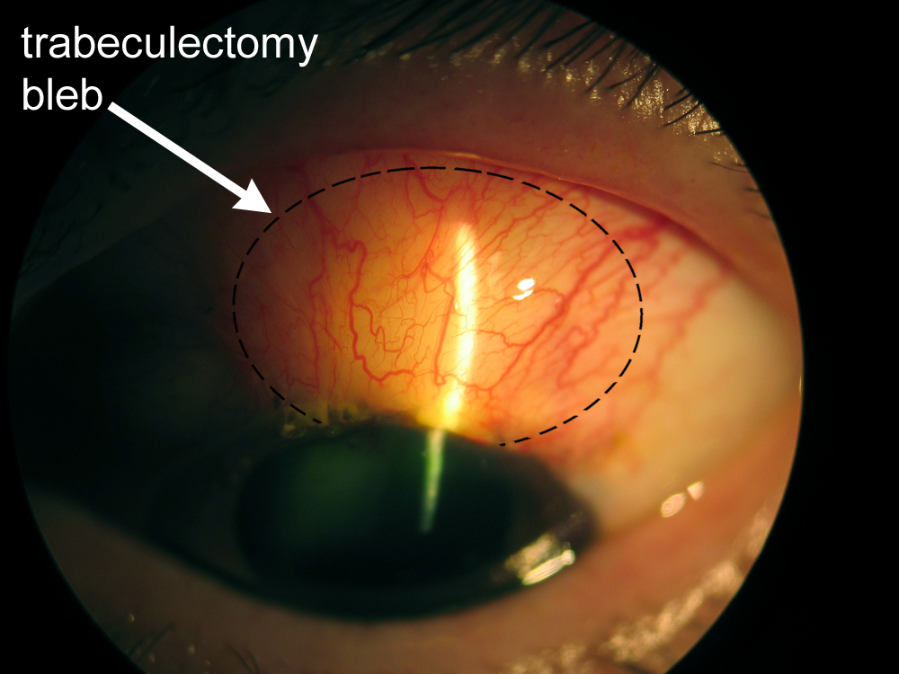 Ch 8 Surgical Treatment of A Patient's Guide to