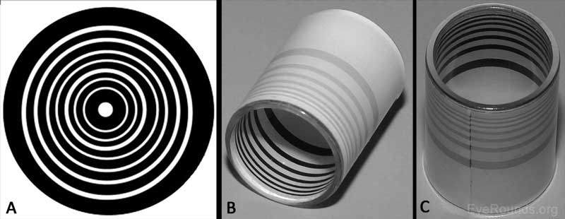  Figure 1. Topographie cornéenne qualitative. A. Disque Placido avec cercles blancs concentriques. B-C. Le kératoscope manuel cylindrique Van Loenen placé devant l'œil du patient au niveau de la lampe à fente réfléchira sept anneaux sur la surface cornéenne pour évaluer rapidement les changements topographiques qualitatifs 