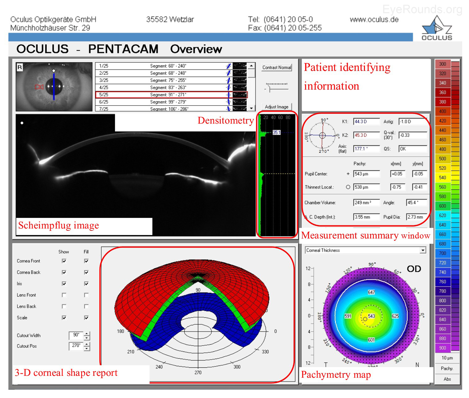 Corneal Imaging An Introduction