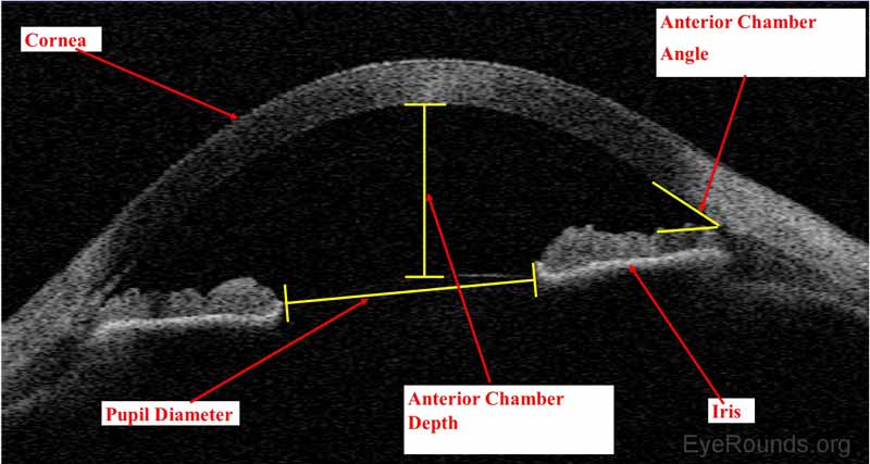 Corneal Imaging: An Introduction