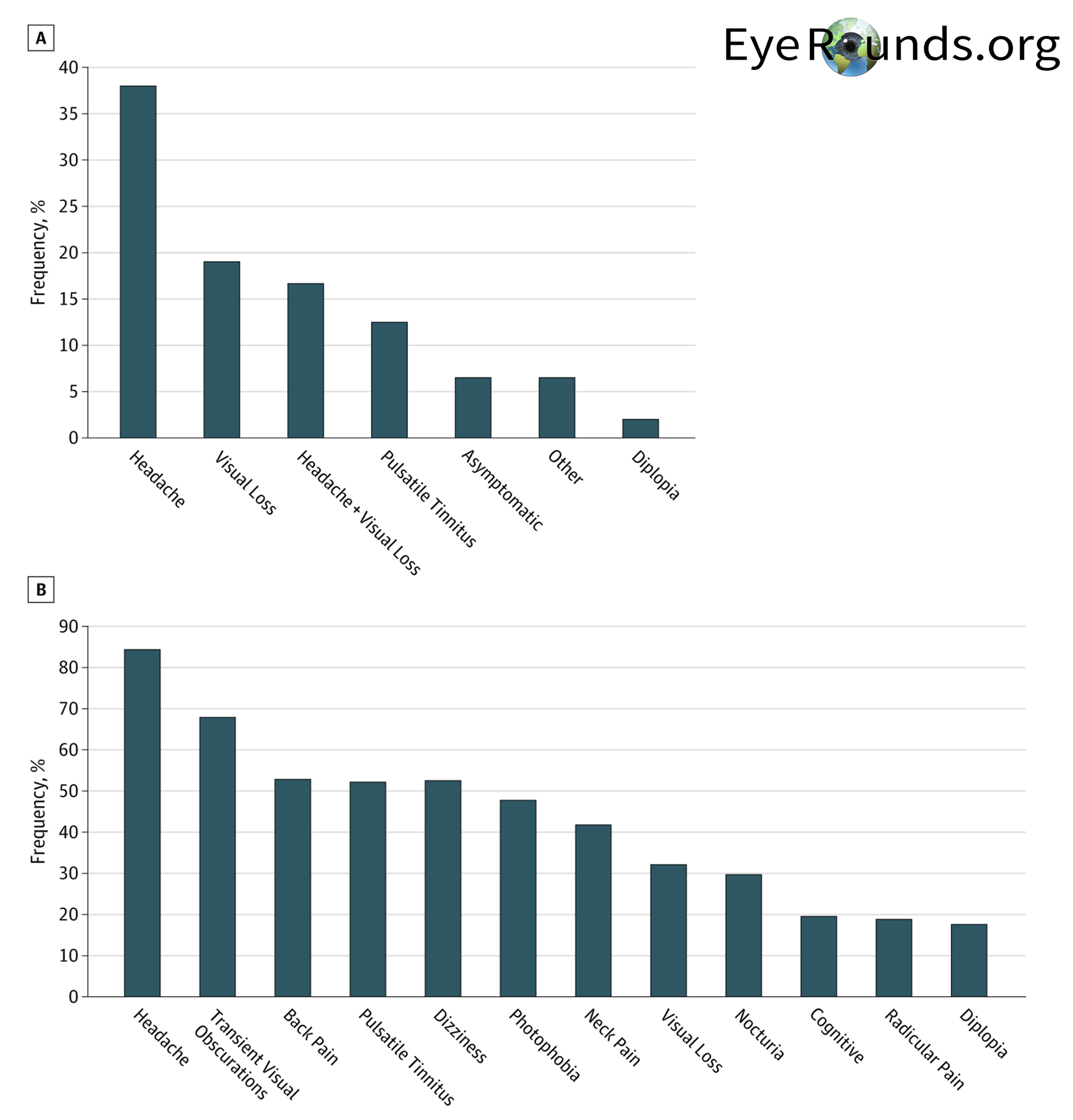 posterior vitreous detachment 