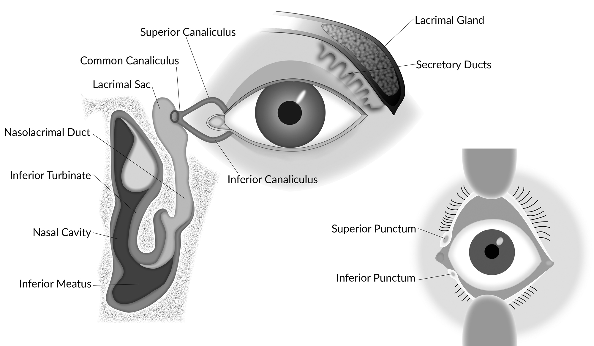 nasolacrimal-stents-an-introductory-guide