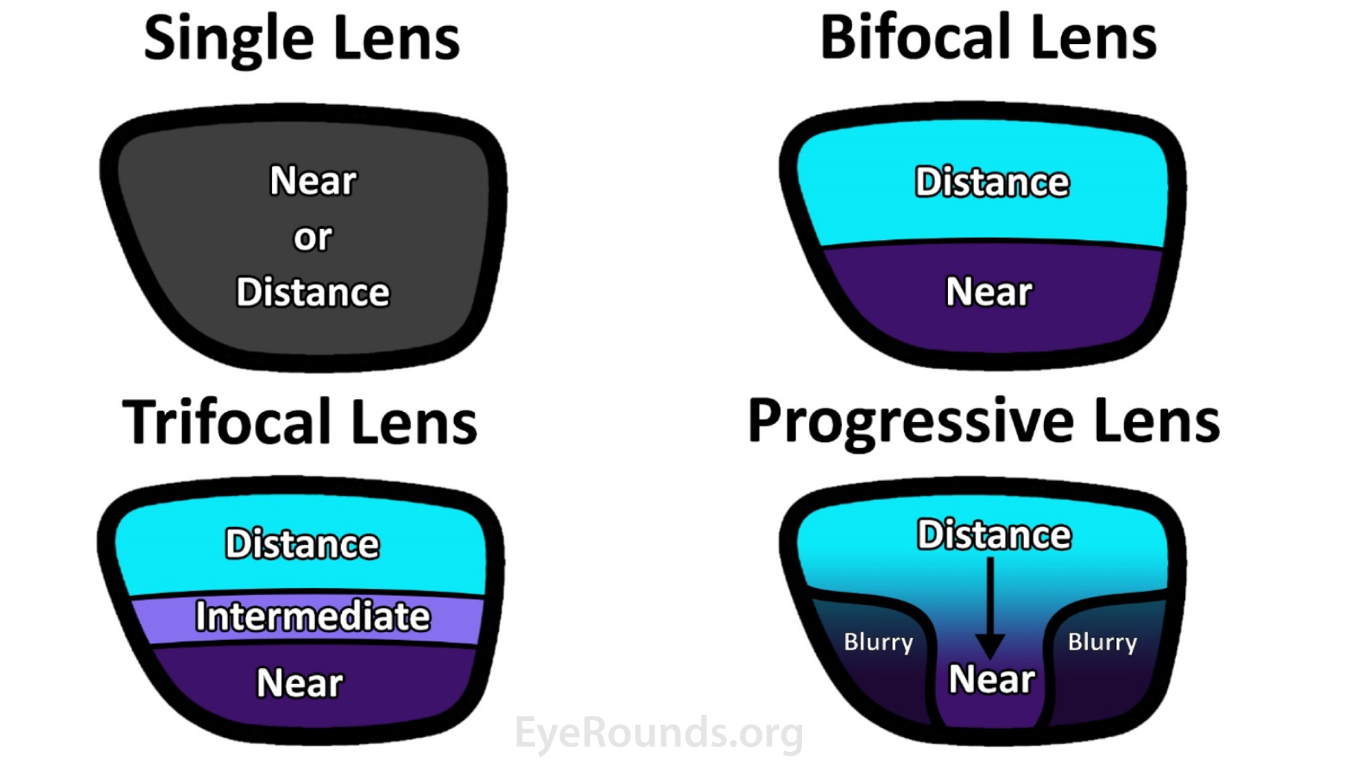 assertion-a-concave-lens-is-used-to-correct-myopia-teachoo-mcq